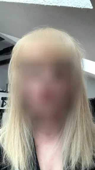 Hanna, 27